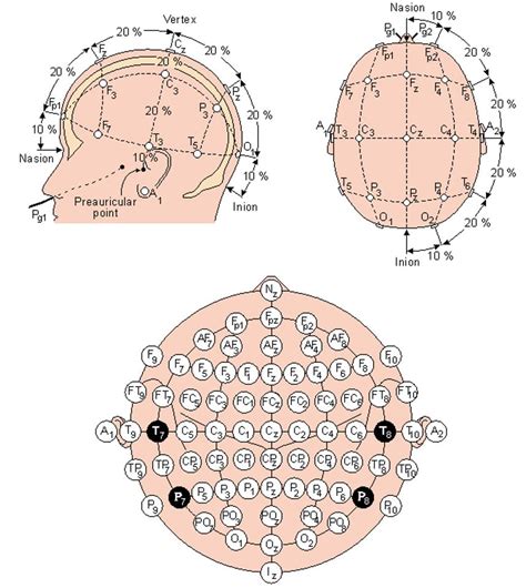 Hd Eeg