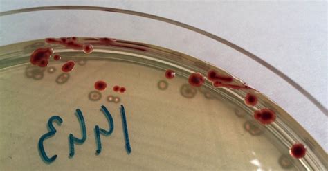 Microbiology Campylobacter Jejuni