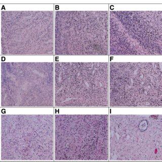 Light Microscopy Images Of Cortical Human Ovarian Tissue Stained With