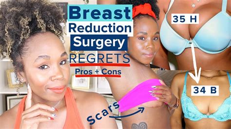 My Breast Reduction Breast Lift REGRETS Plastic Surgery PROS