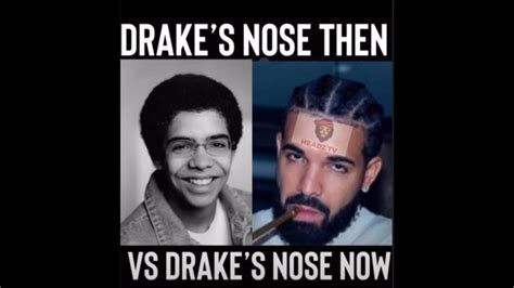 Rick Ross Says Drake Has Fake Nose Youtube