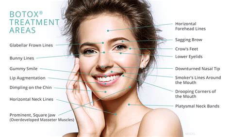 Botox Face Chart Botox Brow Lift