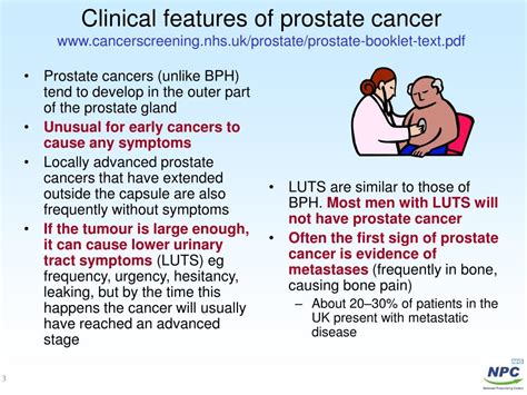 Ppt Prostate Cancer Powerpoint Presentation Free Download Id 63791