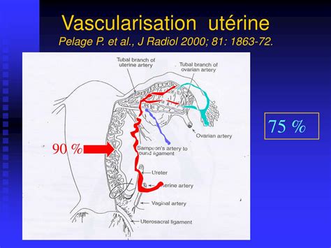 Ppt Hemorragie Du Post Partum Powerpoint Presentation Id