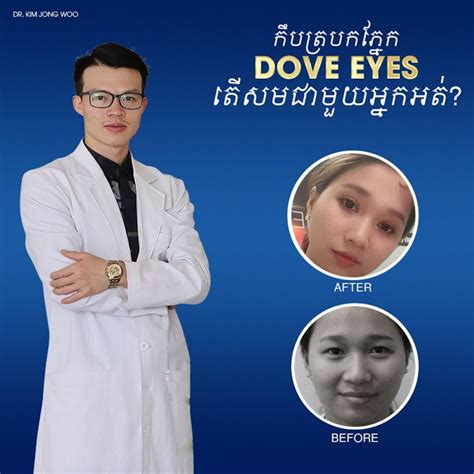 Dr Kim ជំនាញវះកាត់ត្របកភ្នែកនៅ Cambodia - Home