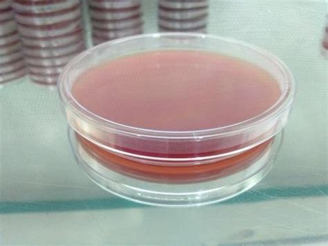 Sheep Blood Agar Plate At Best Price In Pune Aquilina Biocare L L P