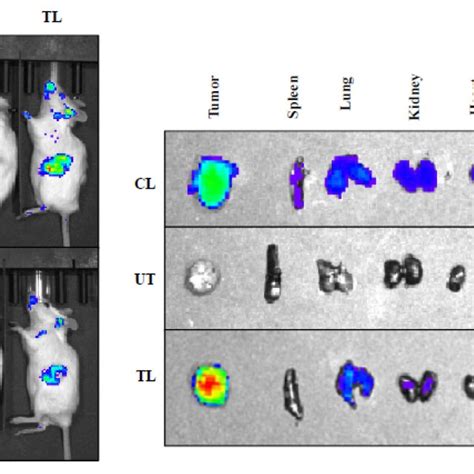 In Vivo Biodistribution Of Ir Dye Labeled Liposomes In Orthotopic