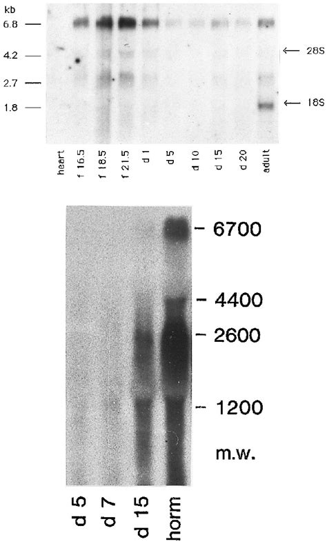 Northern Hybridization Analysis Of Rat Testicular Upper Panel And