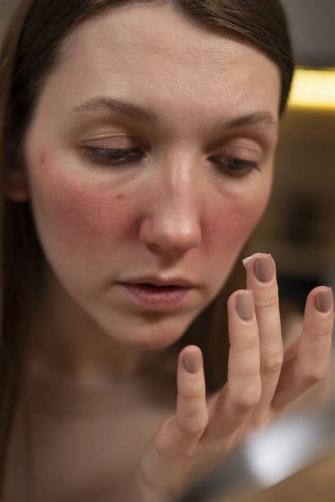 Calming Skincare Routine For Rosacea