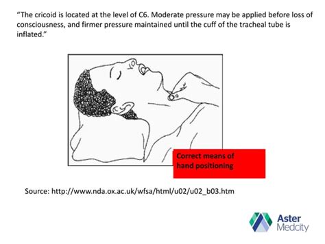 Cricoid pressure -Yes or No?