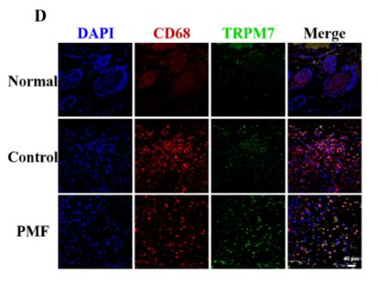 Trpm Antibody Affinity Biosciences