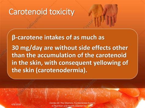 Vitamin A toxicity | PPT