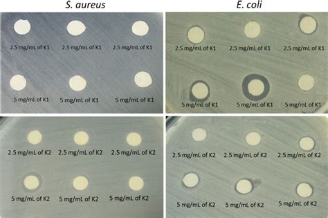 The Formation Of Inhibition Zone On Agar Plates Pre Inoculated With S