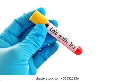 Blood Sample Lipid Profile Test Stock Photo Shutterstock