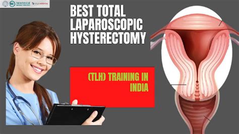 Tillt On Tumblr Best Total Laparoscopic Hysterectomy Tlh Training In