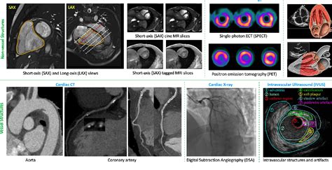 Figure 3 From Artificial Intelligence In Image Based Cardiovascular