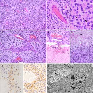 Histological Immunohistochemical And Ultrastructural Findings Of The