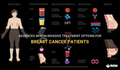 Advances In Non-Invasive Treatment Options For Breast Cancer Patients ...