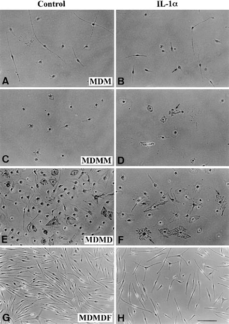 Melanoblasts And Melanocytes In Pure Cultures Derived From Epidermal