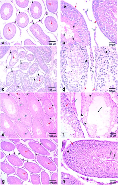 Graphical Photomicrographs Of Testicular Sections From Rats Treated