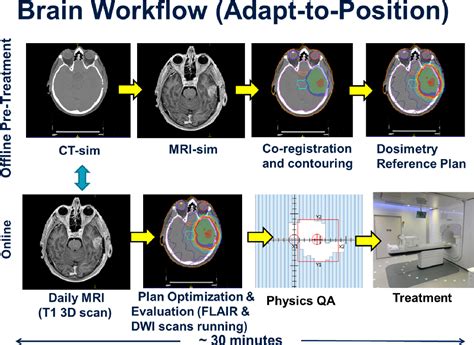 Figure 1 From High Grade Glioma Radiation Therapy On A High Field 1 5