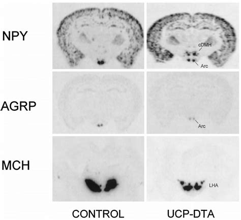 In Situ Hybridization To Npy Agrp And Mch Antisense Probes In Control