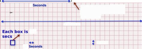 Reading An Ekg Diagram Quizlet