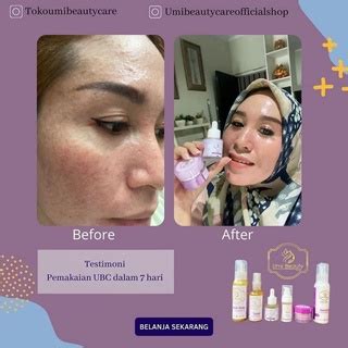 Jual Paket Ekspress Ubc By Umi Alfatih Paket Ubc Umi Beauty Care