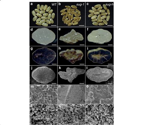 Optical And Scanning Electron Microscopy Observation Of Grain Phenotype