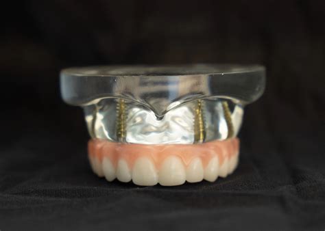 Dentures Grand Dental