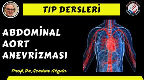 Anevrizmalar Abdominal Aort Anevrizmalar Prof Dr Serdar Akg N