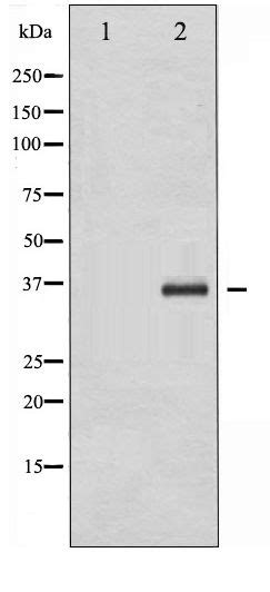 Anti Cebp Beta Cebpb Antibody Rabbit Anti Human Polyclonal Lsbio