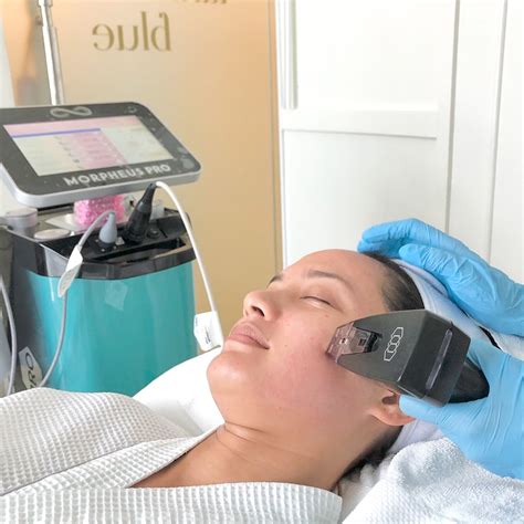 Pearl Morpheus 8 Pro Delivering The Best Of Rf Microneedling Treatment