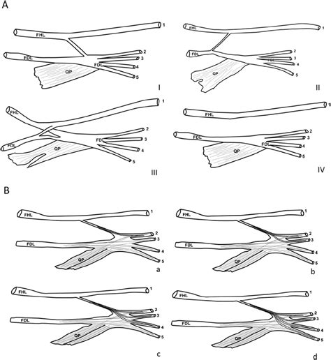 The interconnections between the FHL and FDL tendon were classified in... | Download Scientific ...