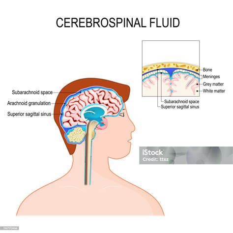 Cairan Serebrospinal Adalah Cairan Bening Di Otak Dan Sumsum Tulang