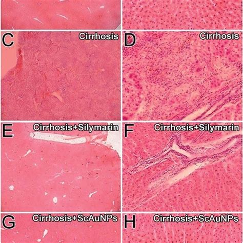 Histological Analysis Of Ccl 4 Induced Chronic 14 Weeks Liver Injury