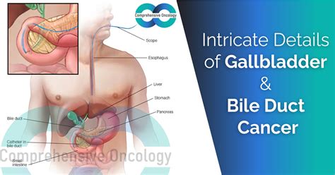 Intricate Details Of Gallbladder And Bile Duct Cancer