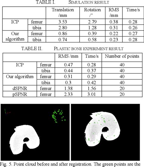 Table Ii From A Registration Method For Total Knee Arthroplasty