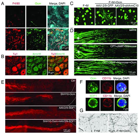 Role Of Ocm Armc And Sdf In Axon Regeneration In The Sciatic Nerve