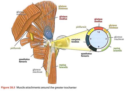 Greater Trochanter