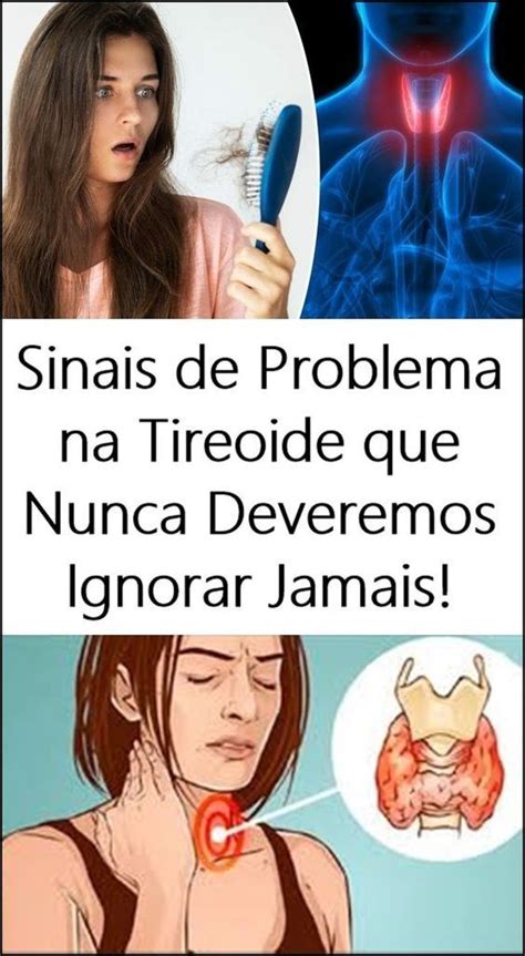 Sinais De Problema Na Tireoide Que Jamais Deve Ignorar Tireoide