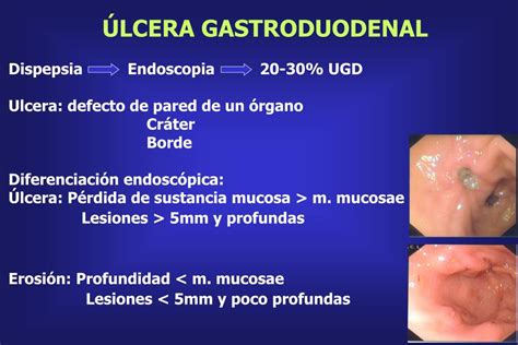 Ppt Aplicaciones De La Endoscopia En El DiagnÓstico De Las