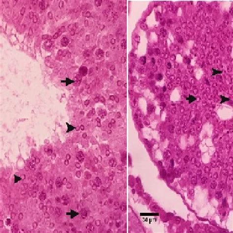 Testis Section Of Left Testis In Control Rats Showing Normal