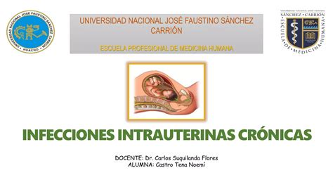 Infecciones Intrauterinas Cr Nicas Pptx