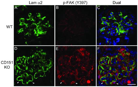 Activation Of Focal Adhesion Kinase Occurs Specifically In Regions Of