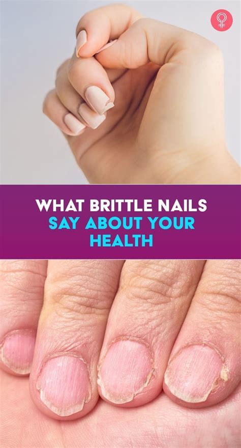 What Brittle Nails Say About Your Health When It Comes To Our