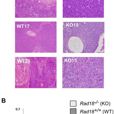 Histopathology Of Dmba Induced Skin Tumors In Rad18 And Rad18