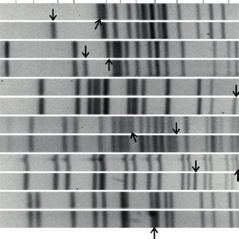 Patterns Obtained By Xbai Restriction And Pulsed Field Gel