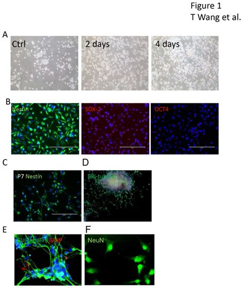 A Non Adherent Cord Blood Cd Cells Ctrl Were Transduced With