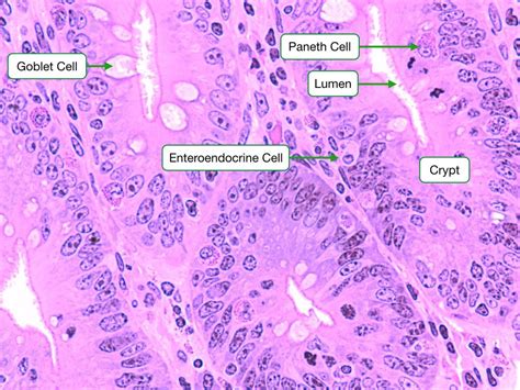 Image result for small intestine - paneth cells microscope | Cell, Microscope, System